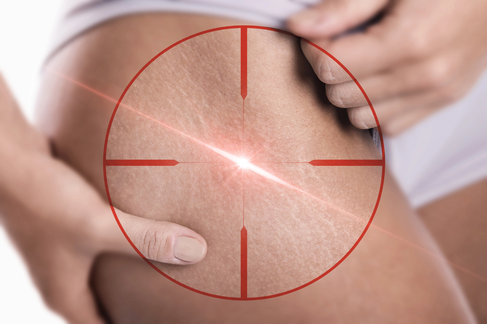 Depositphotos_273354344_S.jpg Depositphotos_273354344_S.jpg